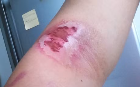 Bi kien ba khoang dot ma chua kieu nay thi hoi han cung khong kip - Anh 2