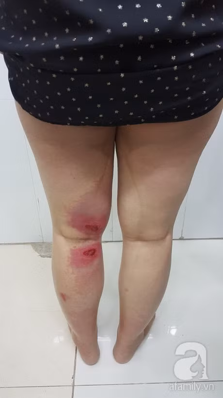 Bi kien ba khoang dot ma chua kieu nay thi hoi han cung khong kip - Anh 3