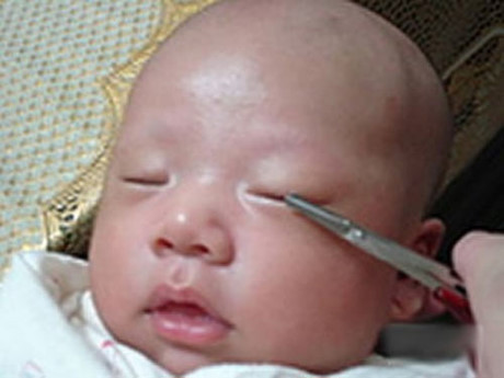 Mẹ vô tình hại con chỉ vì chữa bệnh theo lời truyền miệng - Ảnh 2 Me vo tinh hai con chi vi chua benh theo loi truyen mieng - Anh 2