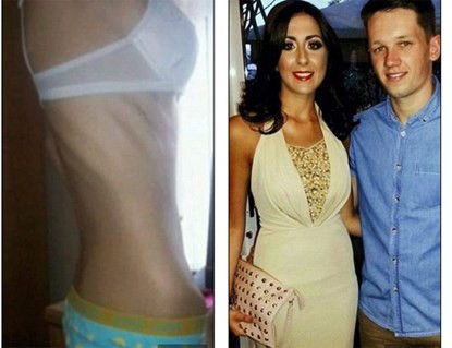 Cô Rebekah thời 23 kg và hiện tại