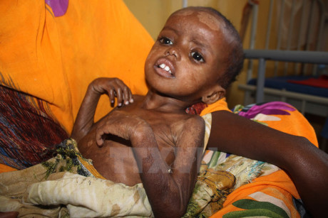 LHQ kêu gọi khẩn cấp ngăn chặn thảm họa chết đói ở Somalia - Ảnh 1 LHQ keu goi khan cap ngan chan tham hoa chet doi o Somalia - Anh 1