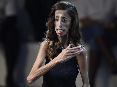 Lizzie Velasquez đã được ca ngợi vì can đảm chống những kẻ chế nhạo cô
