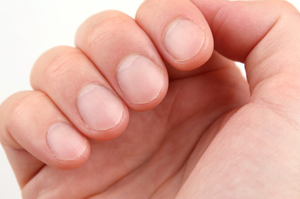Móng tay bị mủn là bệnh gì?
