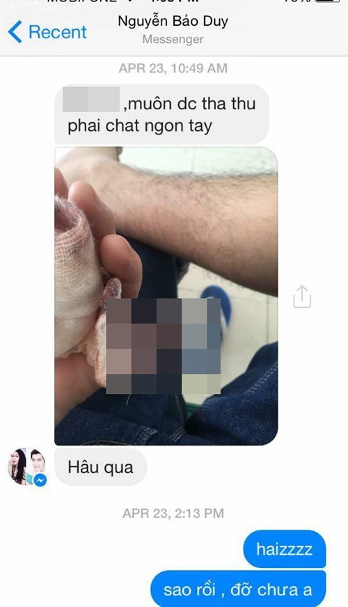 Một người bạn chia sẻ bức ảnh xác nhận chuyện Bảo Duy chặt ngón tay út vì muốn được vợ tha thứ. anh1.jpg