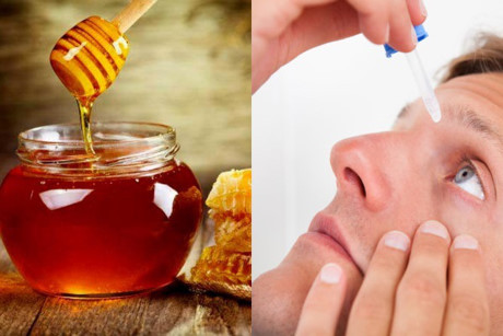 Quên thuốc nhỏ đi, đây là cách trị khô mắt nhanh và an toàn nhất tại nhà - Ảnh 1 Quen thuoc nho di, day la cach tri kho mat nhanh va an toan nhat tai nha - Anh 1