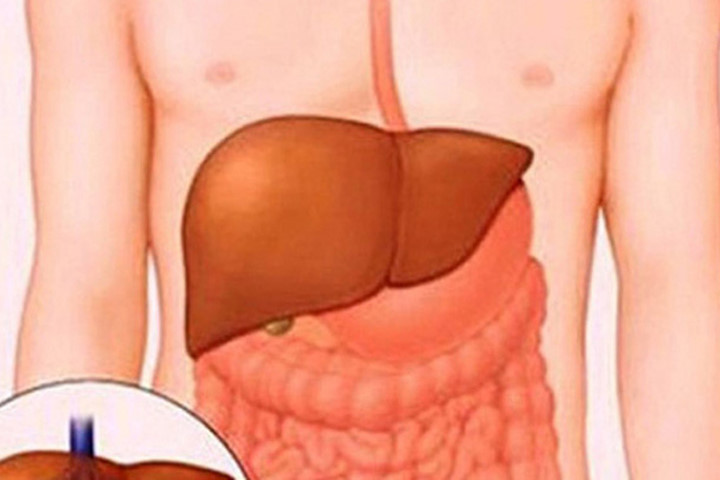 Gan, thận suy yếu vào mùa hè: Hãy ăn những thực phẩm này