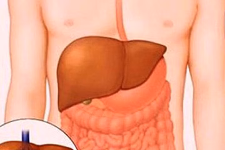 Gan, thận suy yếu vào mùa hè: Hãy ăn những thực phẩm này