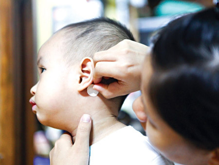 Sử dụng miếng dán chống say xe đúng cách để tránh tác dụng phụ - Ảnh 1 Su dung mieng dan chong say xe dung cach de tranh tac dung phu - Anh 1