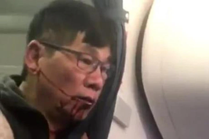 Vụ kiện United Airlines sẽ trở thành "án lệ" của ngành hàng không thế giới