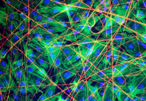 Bất ngờ với tác dụng chữa bệnh tim của tơ nhện - Ảnh 2 Bất ngờ với tác dụng chữa bệnh tim của tơ nhện - Ảnh 2