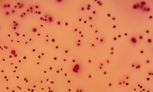 Pháp phát hiện vi khuẩn lạ gây tử vong ở trẻ sơ sinh