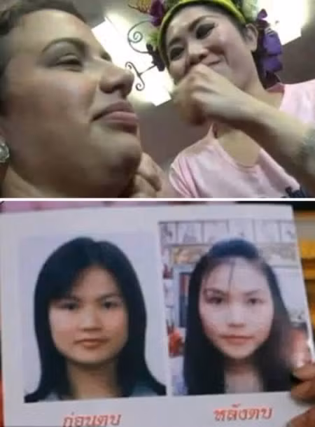 Những phương pháp làm đẹp kỳ lạ trên thế giới 1