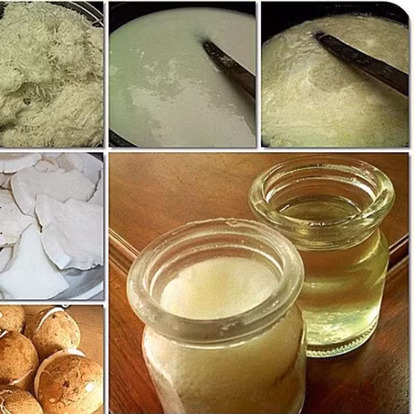 Trao luu giam can bang dau dua va tac hai xo vua dong mach - Anh 2