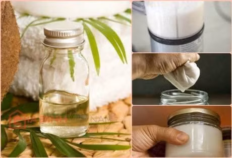 Trao luu giam can bang dau dua va tac hai xo vua dong mach - Anh 1