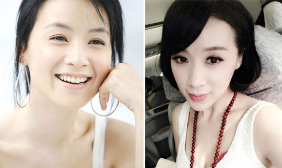 “Hoảng hồn” với 7 chiếc cằm nhọn “thảm hại” của sao nữ ảnh 8 Diêu Thiên Vũ.