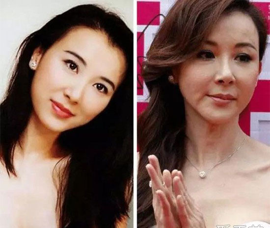 “Hoảng hồn” với 7 chiếc cằm nhọn “thảm hại” của sao nữ ảnh 3 “Hoảng hồn” với 7 chiếc cằm nhọn “thảm hại” của sao nữ ảnh 3