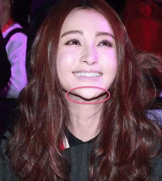 “Hoảng hồn” với 7 chiếc cằm nhọn “thảm hại” của sao nữ ảnh 1 “Hoảng hồn” với 7 chiếc cằm nhọn “thảm hại” của sao nữ ảnh 1