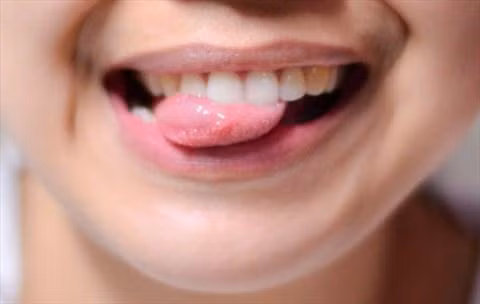 Biểu hiện chứng tỏ cơ thể bạn đang cần bổ sung sắt ngay lập tức