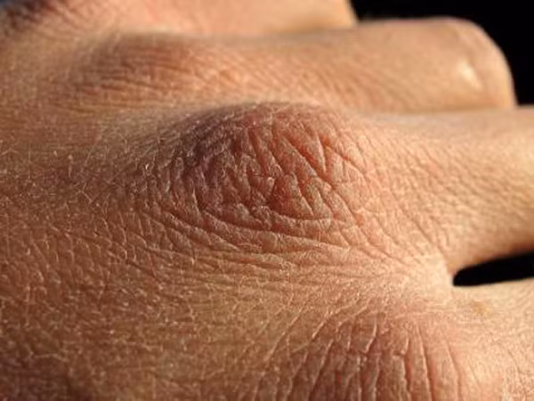 Da tay hết khô, nứt nẻ nếu thực hiện đúng cách