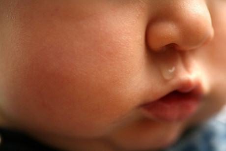 5 mẹo trị dứt điểm tình trạng sổ mũi kéo dài ở bé cực kì hiệu quả - Ảnh 2 5 meo tri dut diem tinh trang so mui keo dai o be cuc ki hieu qua - Anh 2