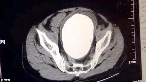 soi-nang-gan-1-2-kg-trong-tui-mat