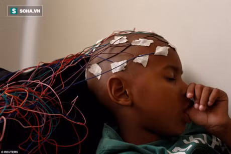 Tre em dong kinh o Venezuela trong con vat va vi thieu thuoc dieu tri - Anh 1