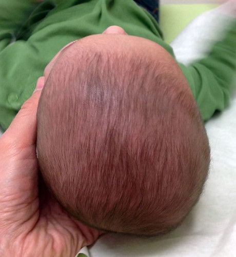 Mối nguy hại khi cho trẻ nhỏ nằm ngửa trong thời gian dài - Ảnh 3 Moi nguy hai khi cho tre nho nam ngua trong thoi gian dai - Anh 3