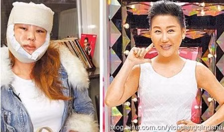 9 giai nhan chau A thua nhan dung cham “dao keo”