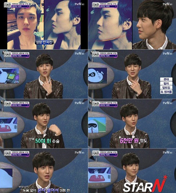 Những chàng trai nghiện phẫu thuật thẩm mỹ ảnh 4 Những chàng trai nghiện phẫu thuật thẩm mỹ