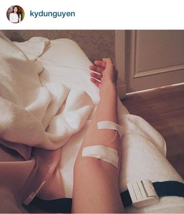 Hoa hậu Kỳ Duyên lộ ảnh gầy đáng báo động ảnh 11 Cô cũng phải truyền nước vì suy nhược cơ thể