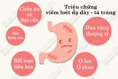 Trị dứt điểm bệnh dạ dày sau 3 tuần bằng hạt sầu riêng cực đơn giản không tốn một xu - Ảnh 1 Tri dut diem benh da day sau 3 tuan bang hat sau rieng cuc don gian khong ton mot xu - Anh 1