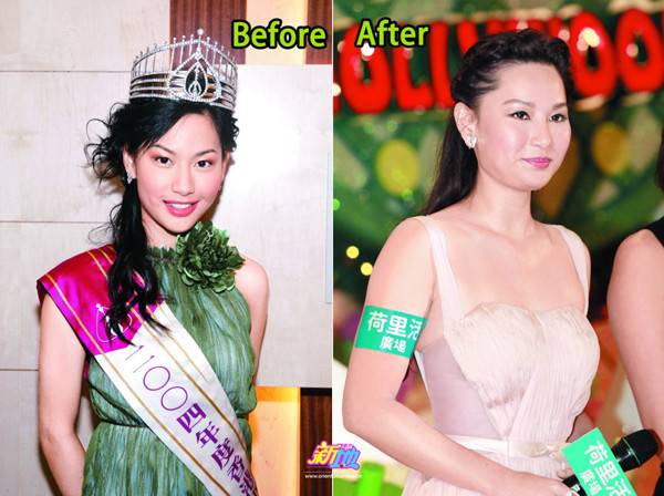 11 cô đào Hong Kong trước "nghi vấn" thẩm mỹ ảnh 2 11-co-dao-hong-kong-truoc-nghi-van-thm-my-1