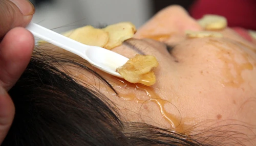 Công thức hết ngay vết sẹo chỉ sau vài lần sử dụng