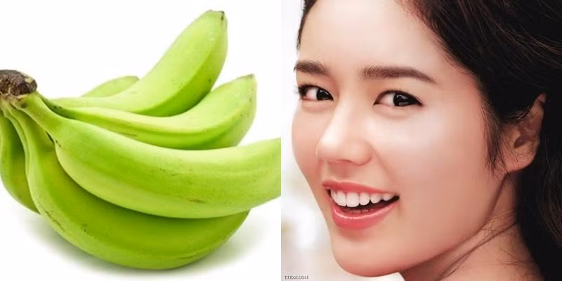 Chuối xanh có công dụng diệt khuẩn và làm mờ rất tốt. trị sẹo thâm