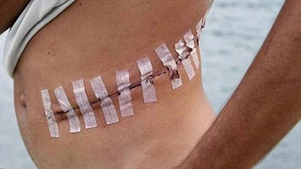 Bên trong "bệnh viện" lấy nội tạng người của IS