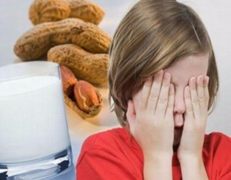 7 loại dị ứng phổ biến và cách phòng ngừa - Ảnh 1 7 loai di ung pho bien va cach phong ngua - Anh 1