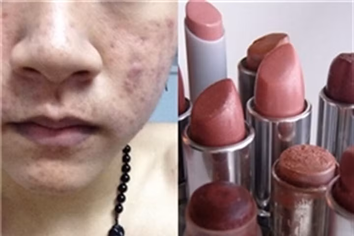 4 hiểm họa kinh hoàng từ thói quen sử dụng mỹ phẩm hết hạn