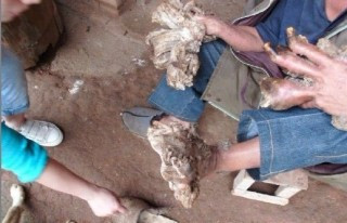 Tay chân mọc ra nhánh như cây khiến việc sinh hoạt của anh Văn bị ảnh hưởng Mô tả ảnh.