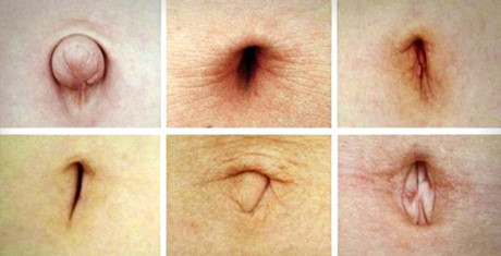 Nhìn hình dạng rốn để chẩn đoán sức khỏe - Ảnh 1 Nhin hinh dang ron de chan doan suc khoe - Anh 1