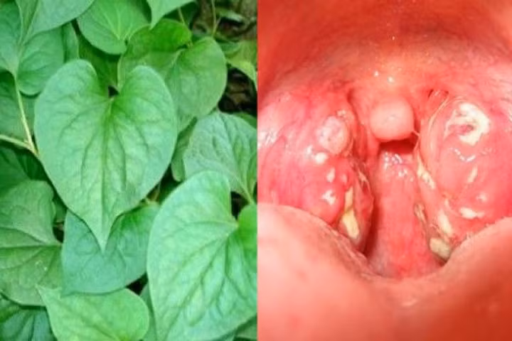 Dùng diếp cá theo cách này, trẻ viêm amidan, họng sưng đỏ rát cỡ nào cũng khỏi hẳn sau 5 ngày