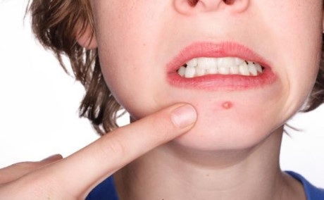 Uống sữa nhiều để đẹp da, khỏe mạnh: Sai lầm nghiêm trọng - Ảnh 2 Uong sua nhieu de dep da, khoe manh: Sai lam nghiem trong - Anh 2