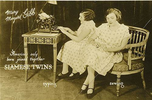 Chuyện tình yêu cảm động của cặp chị em sinh đôi dính liền ảnh 2 Chuyện tình yêu cảm động của cặp chị em sinh đôi dính liền - 2