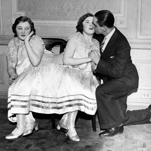 Chuyện tình yêu cảm động của cặp chị em sinh đôi dính liền ảnh 4 Chuyện tình yêu cảm động của cặp chị em sinh đôi dính liền - 4