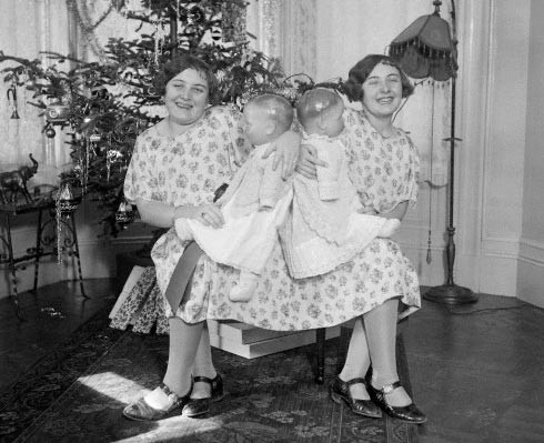 Chuyện tình yêu cảm động của cặp chị em sinh đôi dính liền ảnh 3 Chuyện tình yêu cảm động của cặp chị em sinh đôi dính liền - 3