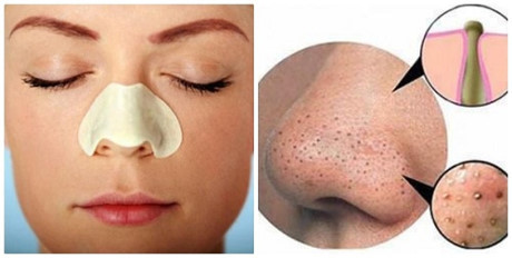 Cách lột mụn đầu đen SIÊU NHANH chỉ bằng 1 quả trứng - Ảnh 7 Cach lot mun dau den SIEU NHANH chi bang 1 qua trung - Anh 7