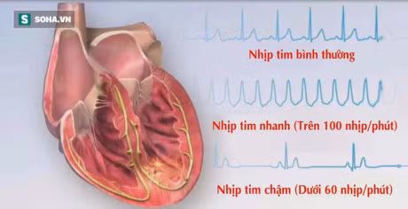 3 dau hieu don gian tu nhan biet ban co the song tho hay khong - Anh 2