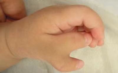 Lam mong khi mang thai, me bau dau don vi da lam hai con - Anh 3