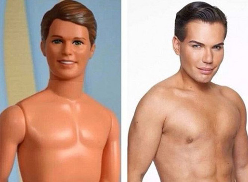 Những ca phẫu thuật làm đẹp kỳ quặc nhất - Ảnh 2