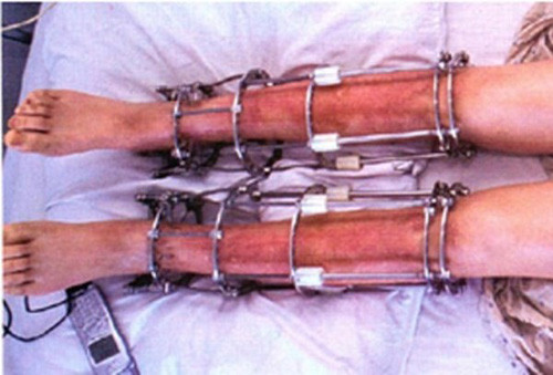 Những ca phẫu thuật làm đẹp kỳ quặc nhất - Ảnh 4