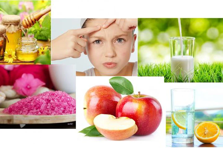 7 liệu pháp trị mụn bọc dễ làm tại nhà